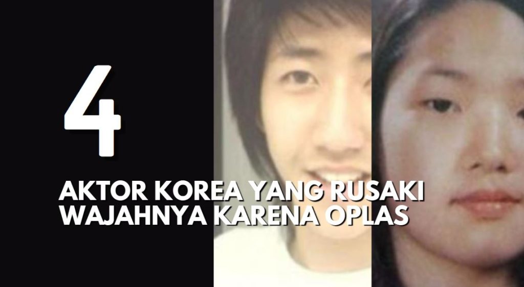 4 Aktor Korea yang Mengubah Wajahnya Karena Operasi Plastik 1 4 Aktor Korea yang Mengubah Wajahnya Karena Operasi Plastik