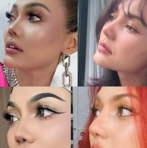 Rina Nose Oplas Hidung